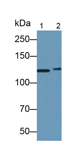 Polyclonal Antibody to N-cadherin (NCAD)