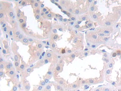 Polyclonal Antibody to N-cadherin (NCAD)