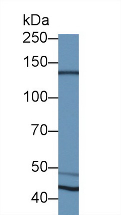 Polyclonal Antibody to N-cadherin (NCAD)