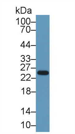 Polyclonal Antibody to Pancreatic Elastase 1 (ELA1)