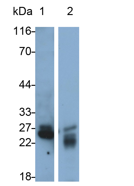 Polyclonal Antibody to Pancreatic Elastase 1 (ELA1)