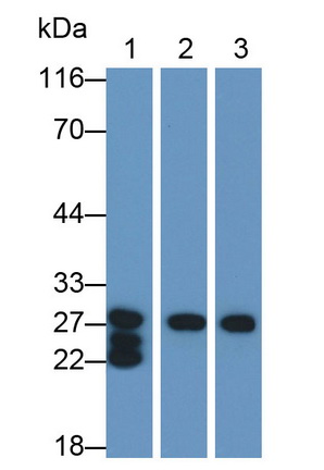 Polyclonal Antibody to Pancreatic Elastase 1 (ELA1)