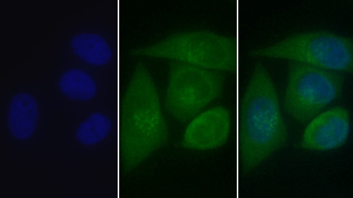 Polyclonal Antibody to Calreticulin (CALR)