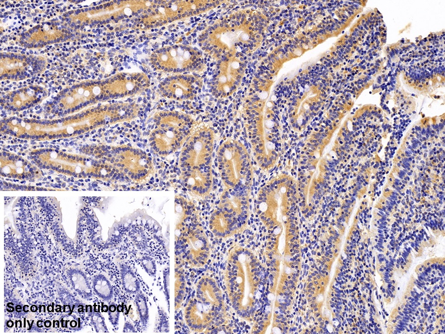 Polyclonal Antibody to Calreticulin (CALR)