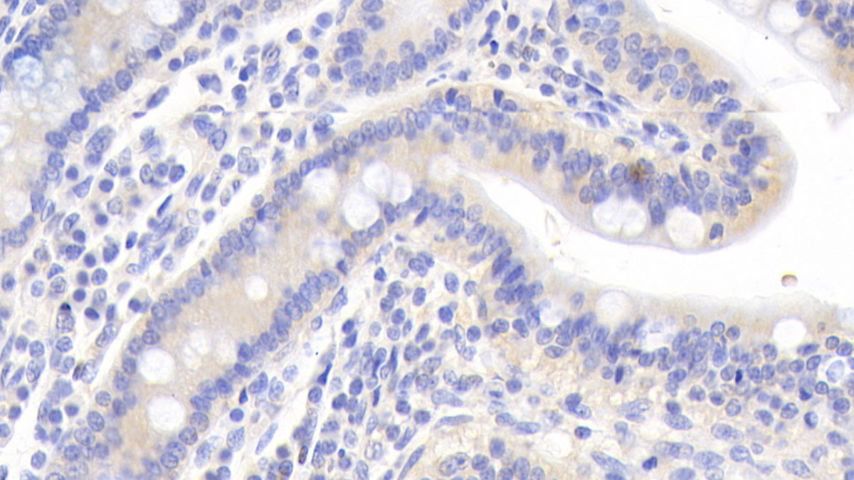 Polyclonal Antibody to Calreticulin (CALR)