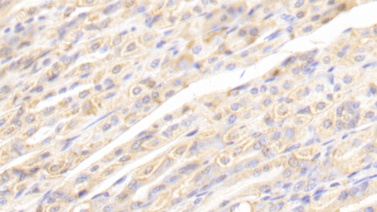 Polyclonal Antibody to Calreticulin (CALR)