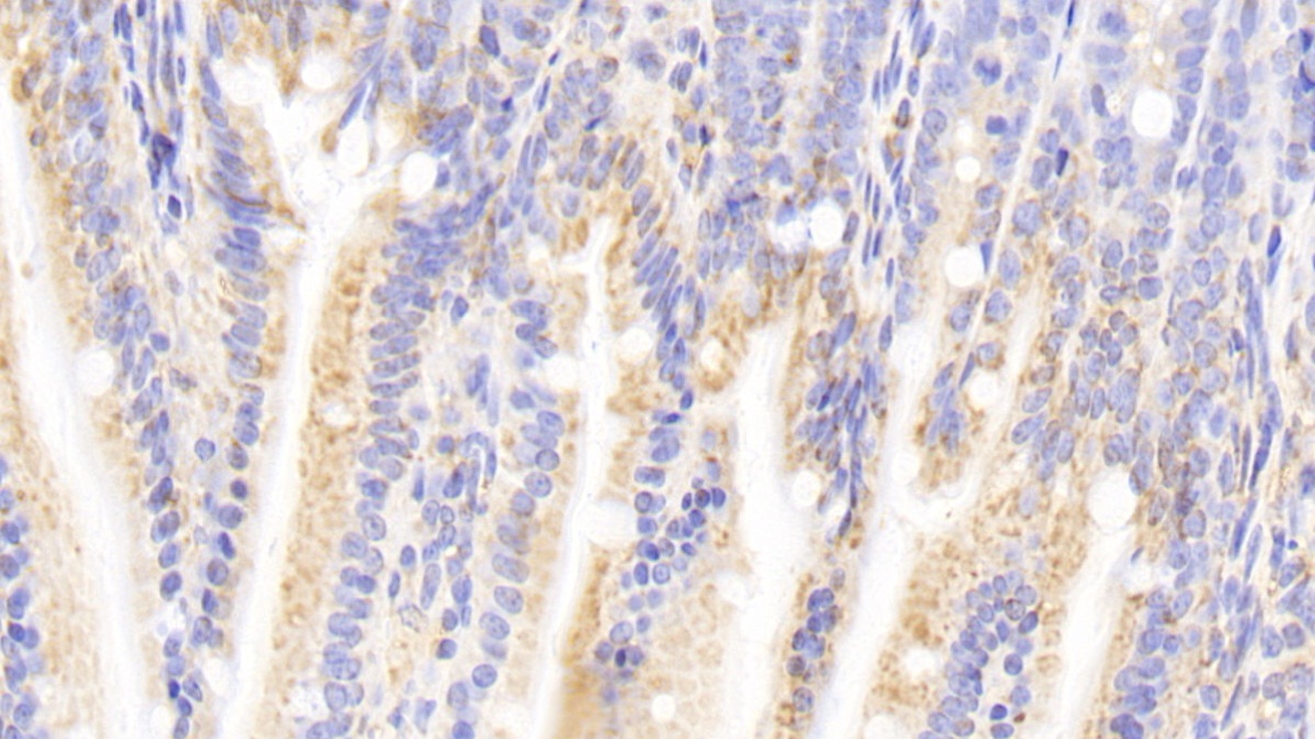 Polyclonal Antibody to Calreticulin (CALR)