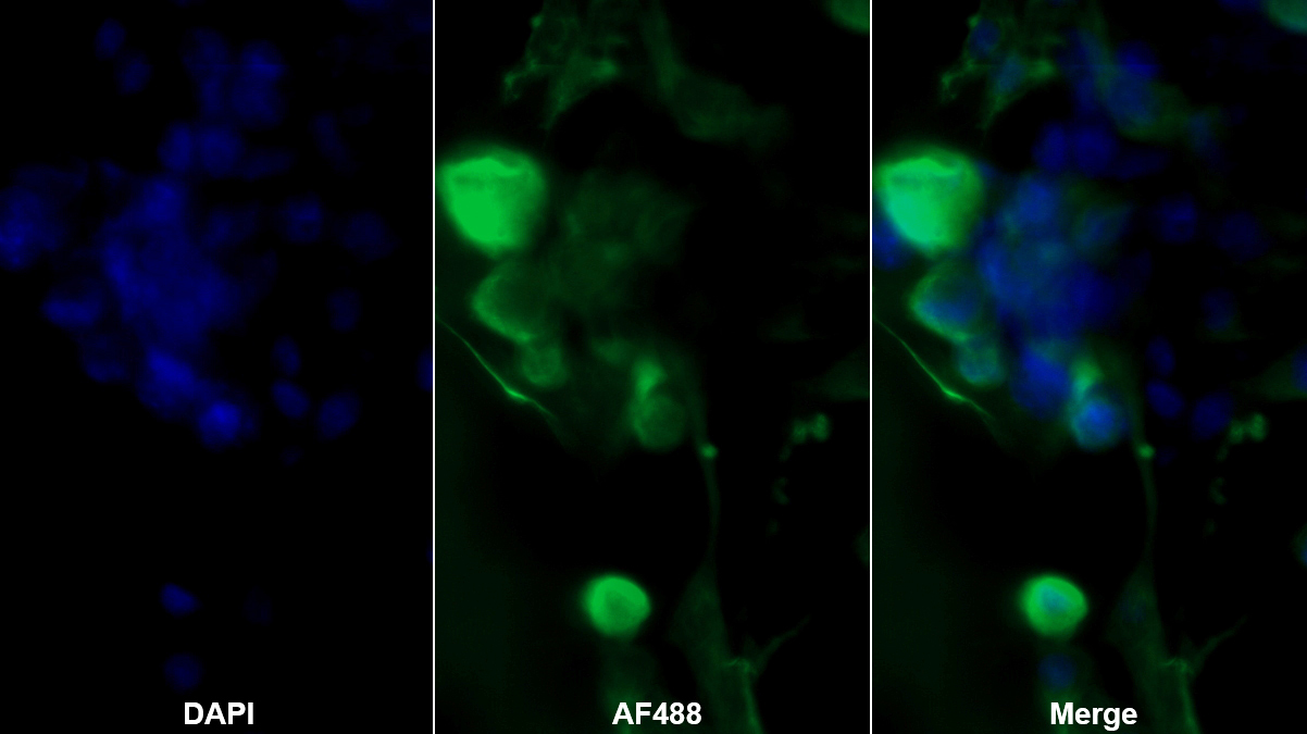 Polyclonal Antibody to Ornithine Transcarbamylase (OTC)