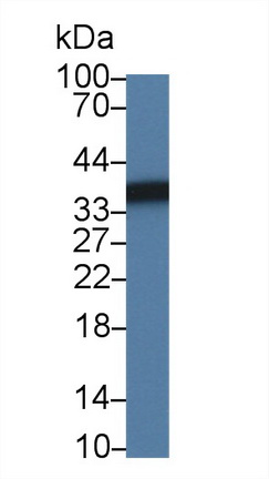 Polyclonal Antibody to Sorbitol Dehydrogenase (SDH)