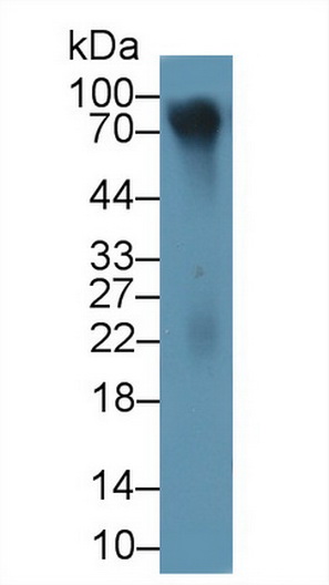 Polyclonal Antibody to Lumican (LUM)