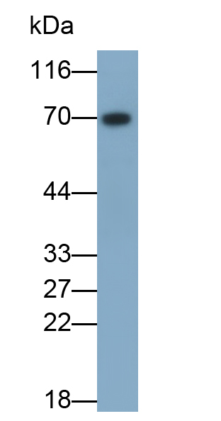 Polyclonal Antibody to Lumican (LUM)