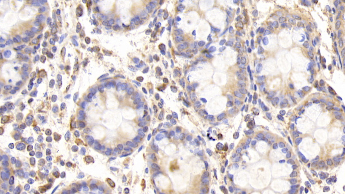 Polyclonal Antibody to Endoplasmic Reticulum Resident Protein 57 (ERp57)