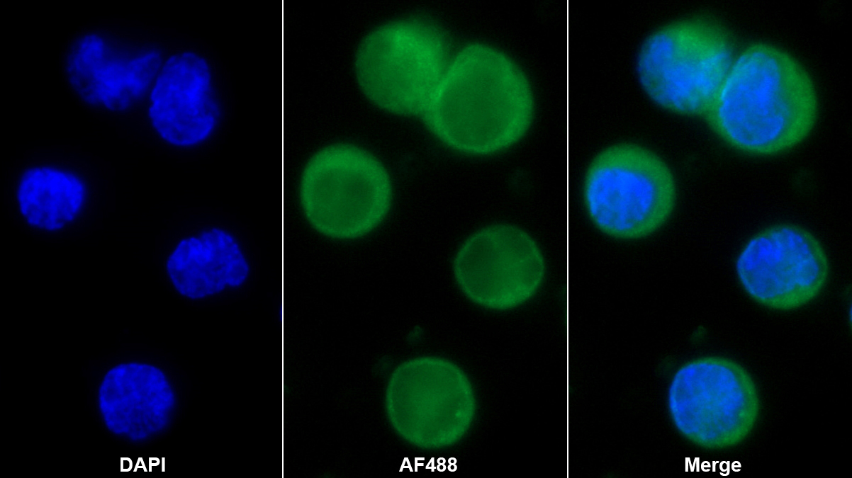 Polyclonal Antibody to Protein Disulfide Isomerase (PDI)