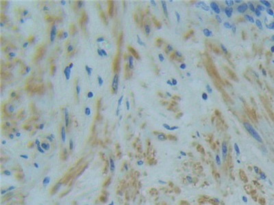 Polyclonal Antibody to Tumor Necrosis Factor Receptor 1 (TNFR1)