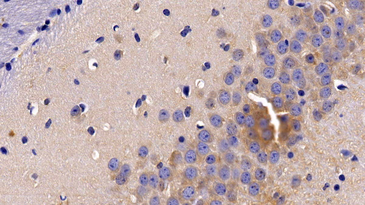 Polyclonal Antibody to Tumor Necrosis Factor Receptor 1 (TNFR1)