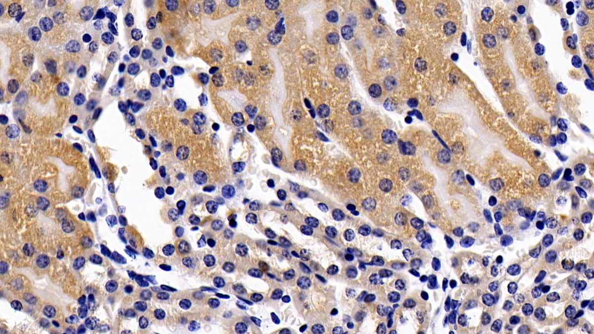 Polyclonal Antibody to Tumor Necrosis Factor Receptor 1 (TNFR1)