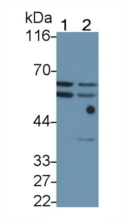 Polyclonal Antibody to Tumor Necrosis Factor Receptor 1 (TNFR1)