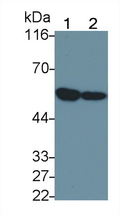 Polyclonal Antibody to Tumor Necrosis Factor Receptor 1 (TNFR1)