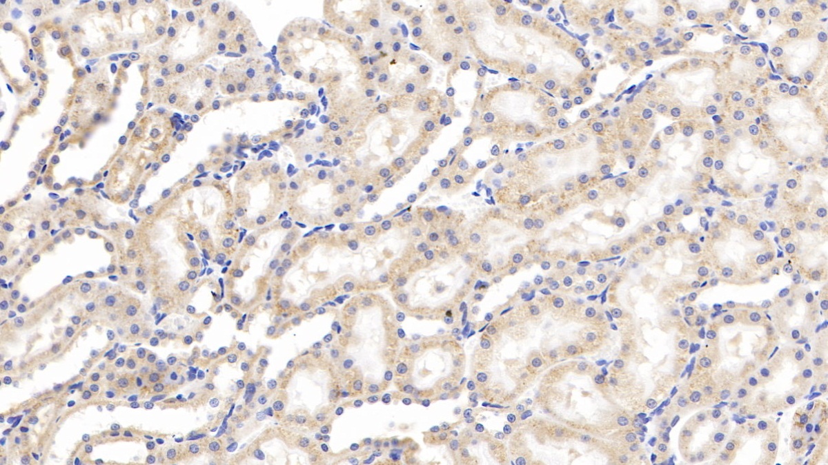 Polyclonal Antibody to Tumor Necrosis Factor Receptor 1 (TNFR1)