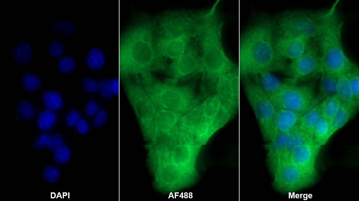 Polyclonal Antibody to Tumor Necrosis Factor Receptor 1 (TNFR1)