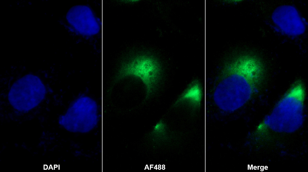 Polyclonal Antibody to Killer Cell Lectin Like Receptor Subfamily C, Member 2 (KLRC2)