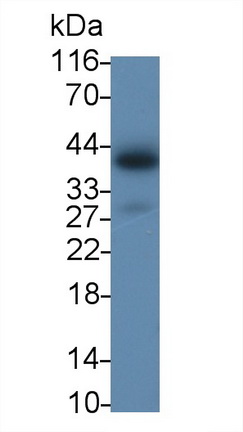 Polyclonal Antibody to Interleukin 2 Receptor Gamma (IL2Rg)