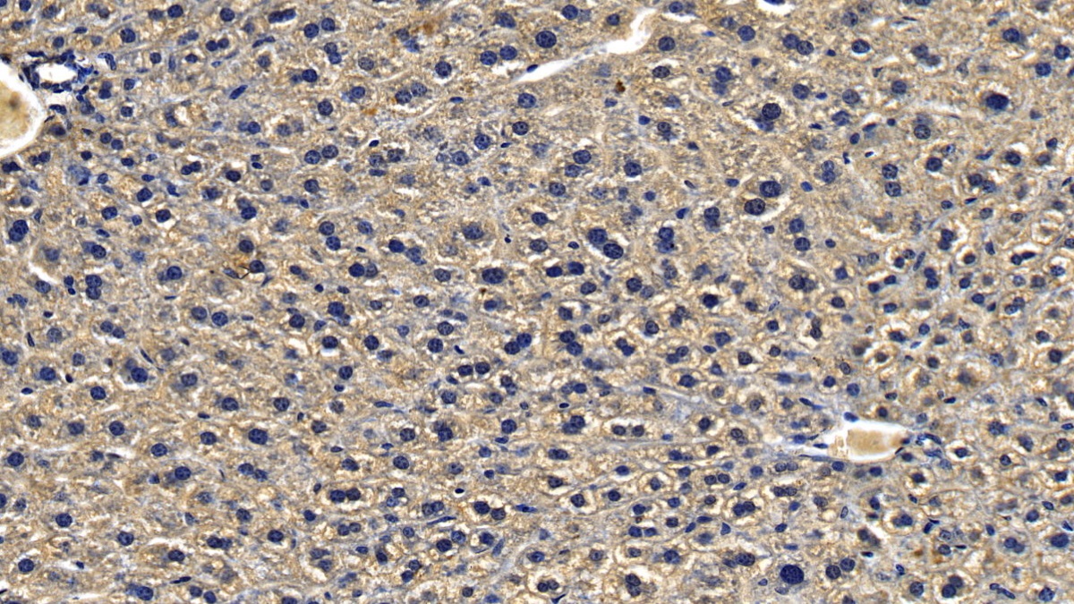 Polyclonal Antibody to Interleukin 1 Receptor Associated Kinase 4 (IRAK4)