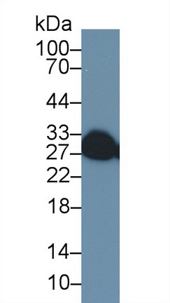 Polyclonal Antibody to Tumor Necrosis Factor Receptor Superfamily, Member 9 (TNFRSF9)