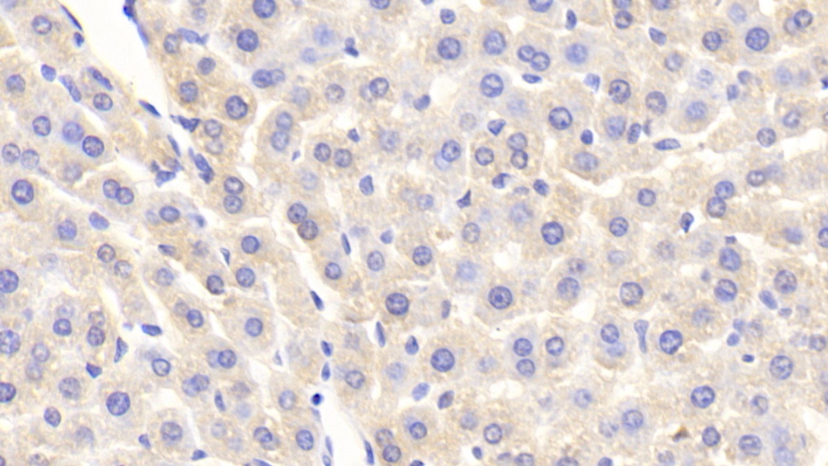 Polyclonal Antibody to Serum Amyloid P Component (SAP)