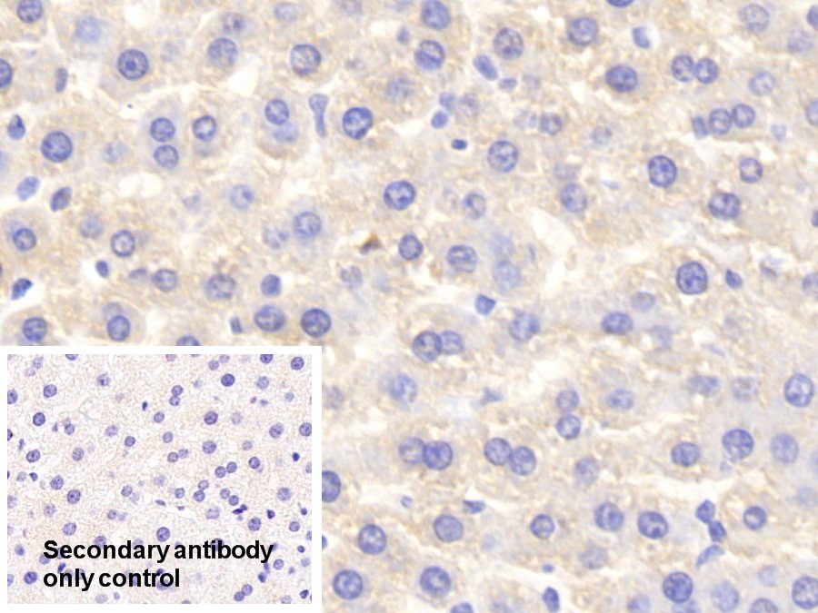 Polyclonal Antibody to Serum Amyloid P Component (SAP)