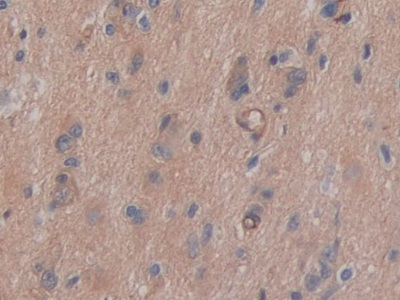 Polyclonal Antibody to Cluster Of Differentiation 147 (CD147)