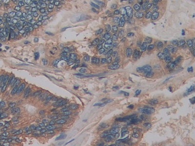 Polyclonal Antibody to Cluster Of Differentiation 147 (CD147)