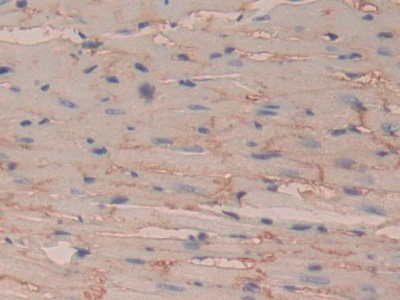 Polyclonal Antibody to Cluster Of Differentiation 147 (CD147)