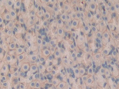 Polyclonal Antibody to Cluster Of Differentiation 147 (CD147)