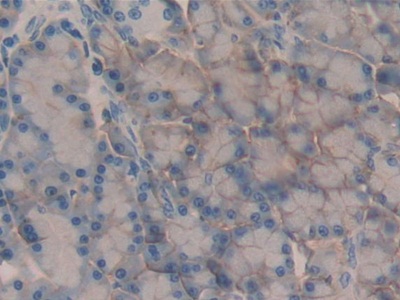 Polyclonal Antibody to Cluster Of Differentiation 147 (CD147)