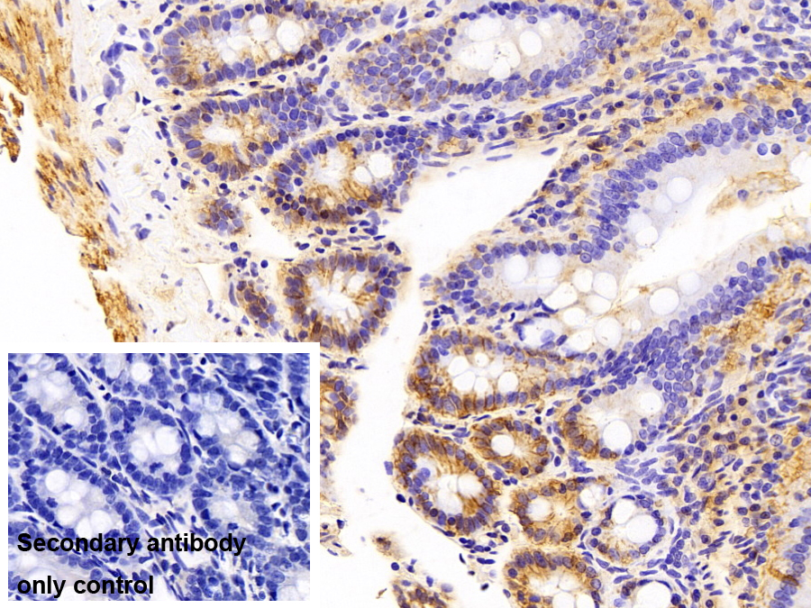 Polyclonal Antibody to Cluster Of Differentiation 147 (CD147)