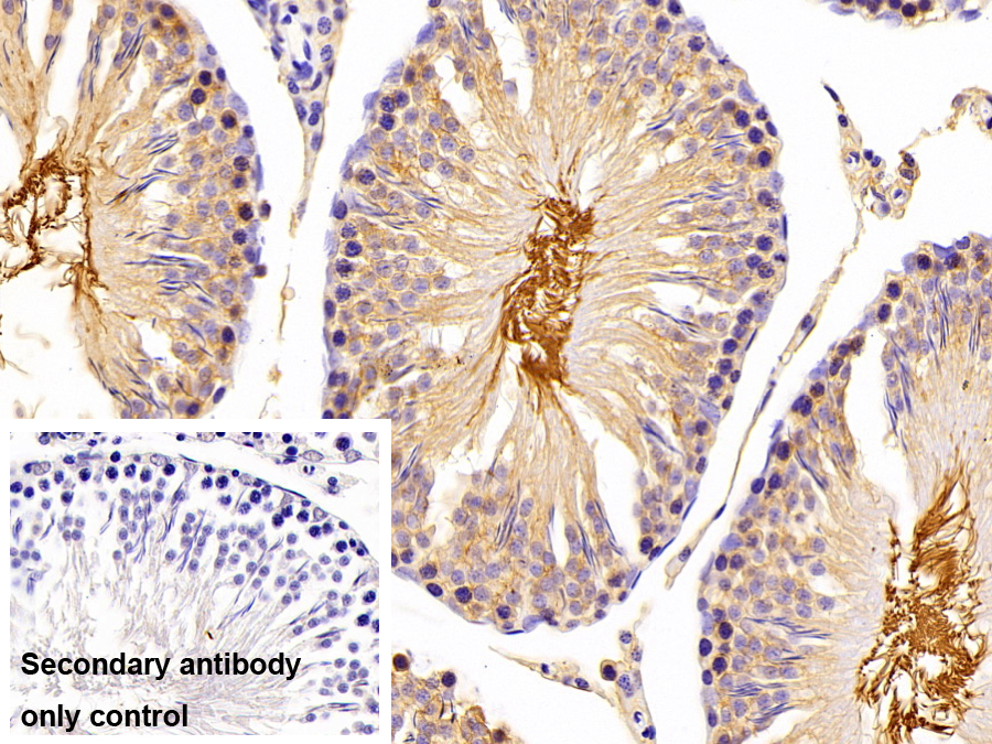 Polyclonal Antibody to Cluster Of Differentiation 147 (CD147)