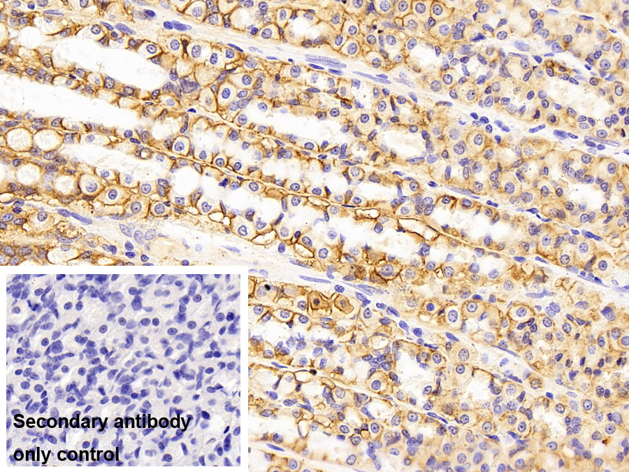 Polyclonal Antibody to Cluster Of Differentiation 147 (CD147)
