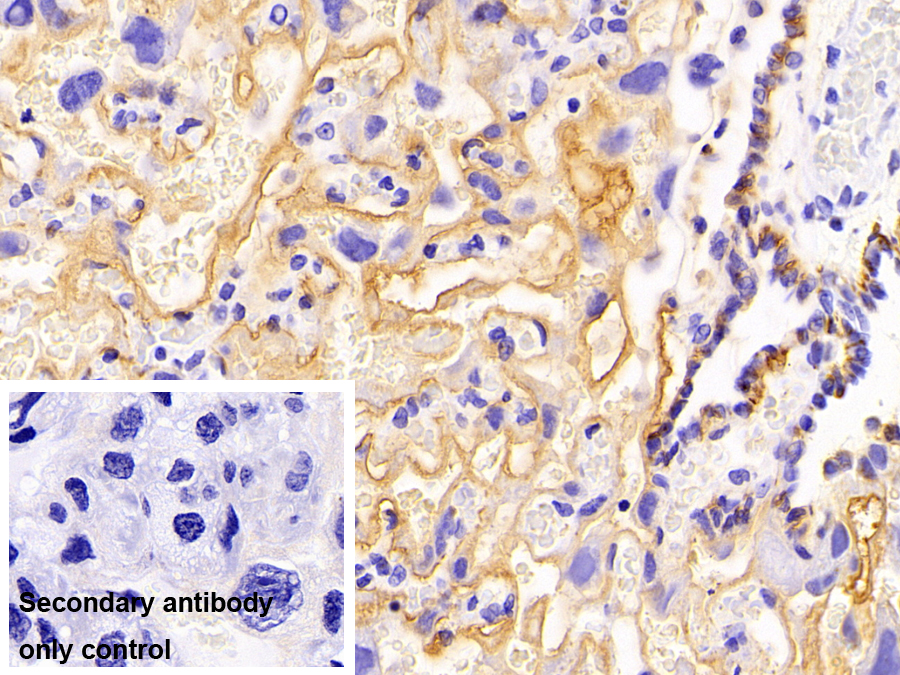 Polyclonal Antibody to Cluster Of Differentiation 147 (CD147)
