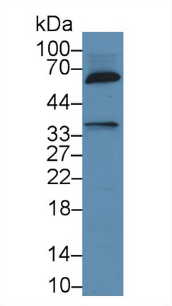 Polyclonal Antibody to Signaling Lymphocytic Activation Molecule Family, Member 1 (SLAMF1)