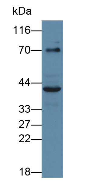 Polyclonal Antibody to Poliovirus Receptor (PVR)