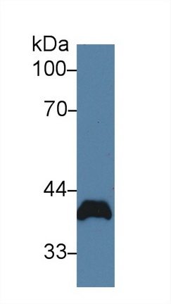 Polyclonal Antibody to Poliovirus Receptor (PVR)