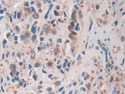 Polyclonal Antibody to Cofilin 1 (CFL1)