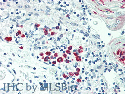 Polyclonal Antibody to Lymphotoxin Beta (LTb)