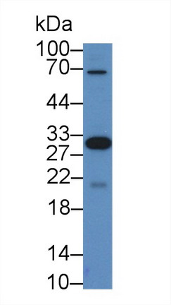 Polyclonal Antibody to Killer Cell Immunoglobulin Like Receptor 2DS4 (KIR2DS4)