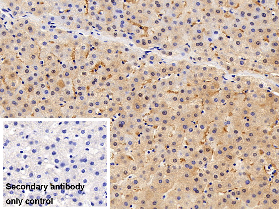 Polyclonal Antibody to Fatty Acid Binding Protein 1 (FABP1)