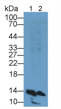 Polyclonal Antibody to Fatty Acid Binding Protein 1 (FABP1)