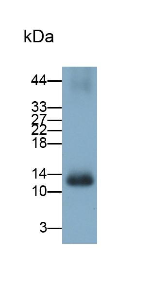 Polyclonal Antibody to Fatty Acid Binding Protein 1 (FABP1)