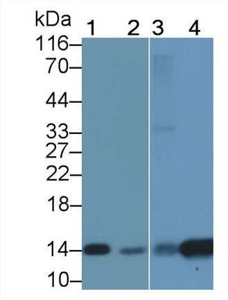 Polyclonal Antibody to Fatty Acid Binding Protein 1 (FABP1)