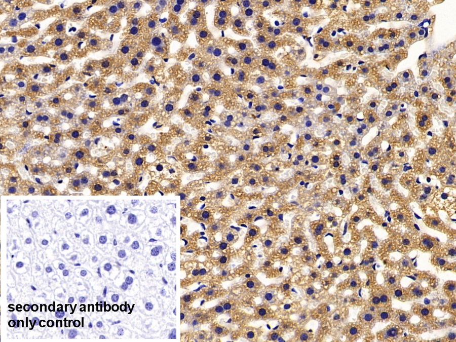 Polyclonal Antibody to Fatty Acid Binding Protein 1 (FABP1)